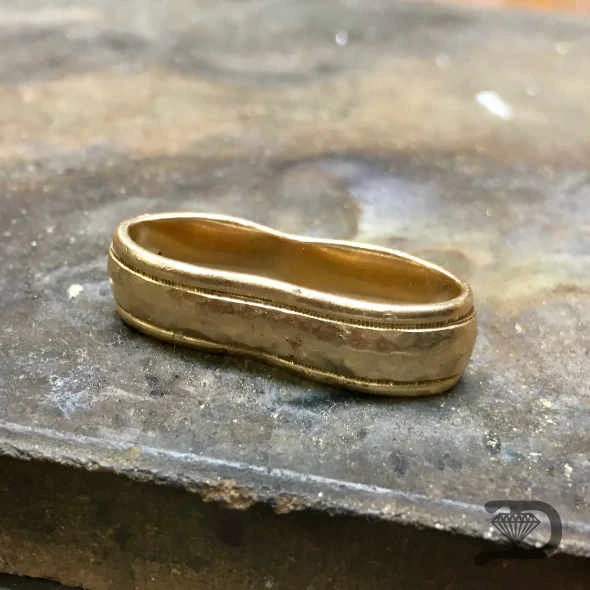 Gold band — structural restoration — before